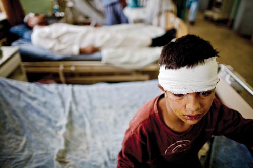 A dazed-looking boy perches on the edge of a hospital bed. His head is wrapped in bandages. His eyes are swollen, and his face is stained yellow in places. Behind him can be seen a man reclining in a neighboring bed.