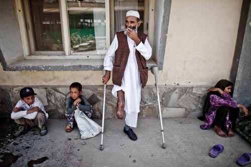 A bearded, middle-aged man leans against the outside wall of a building. Crutches lean against the wall on either side of him. One pant leg is rolled up to reveal that he's missing his leg below the knee. He smokes. On either side of him, children crouch against the same wall.