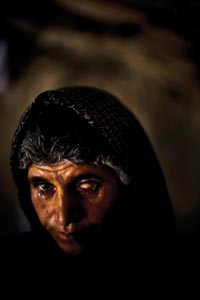 A serious, sad middle-aged woman looks at the camera. Her head is covered by a dark headscarf. One eye has no iris, just white sclera. It is surrounded by scar tissue on her cheek.