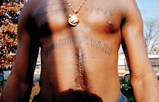 The torso of a man, from his upper chest down to his waist. Several tattoos are visible ('NO MORE PAIN' is most prominent), a gold medallion of a bulldog's head hangs from a thick chain around his neck, and a wide, striated scar runs vertically down the center of his abdomen.
