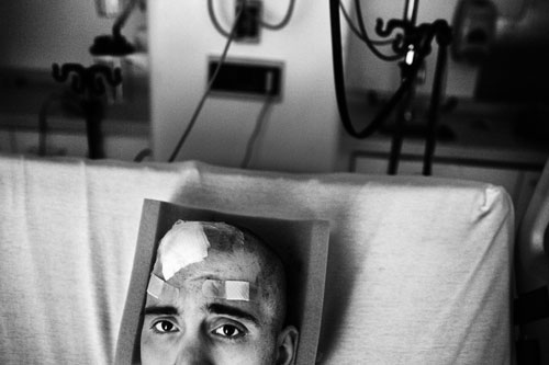 A closeup shot of Nick in his hospital bed with several bandages and gauze on his scalp.  There is medical machinery in the background behind him.