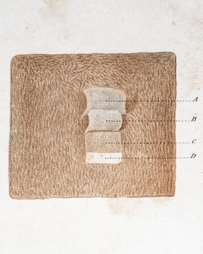 Human skin layers of “tanned skin.” <i>Dictionnaire universel d’histoire naturelle</i>, Charles Dessalines d’Orbigny. Photograph by Ben Rasmussen.