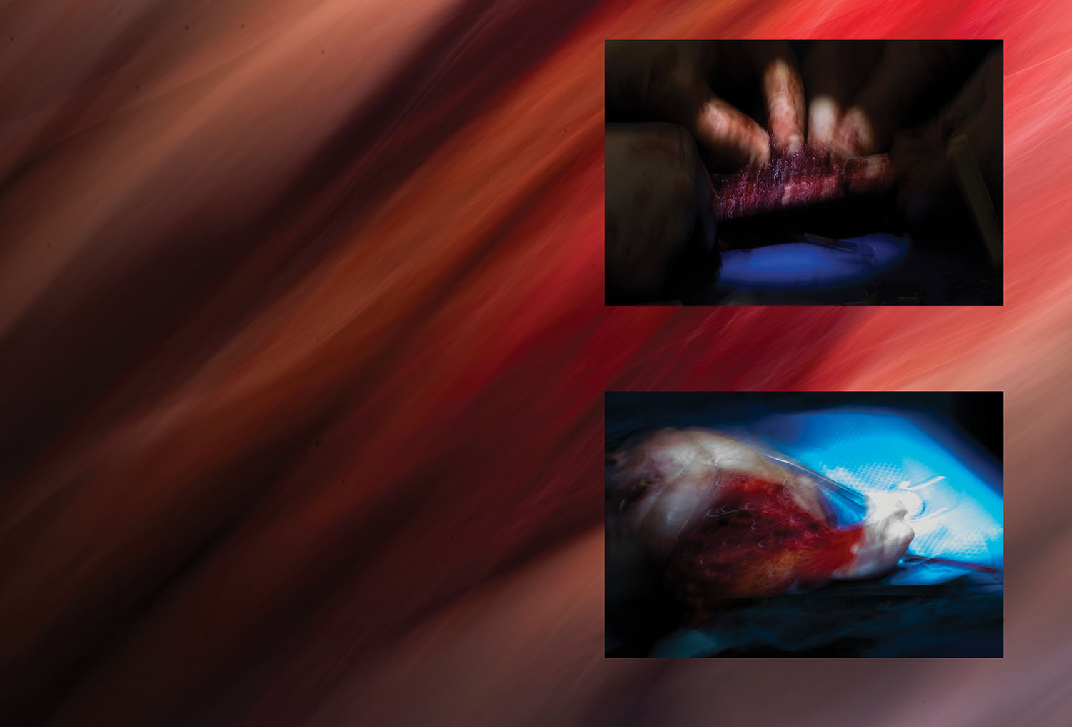blurry photos of surgery